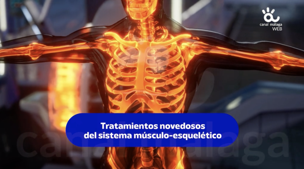 Imagen representativa del sistema musculoesquelético humano, usada por Imatde Arthrosport en colaboración con los Hospitales HM de Málaga para presentar tratamientos innovadores en traumatología.