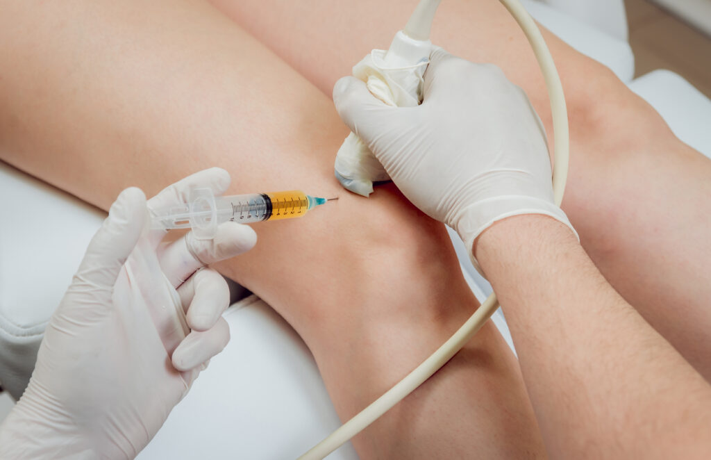 Unidad de Medicina Regenerativa 2 Infiltración rodilla unidad de medicina regenerativa imatde arthrosport málaga
